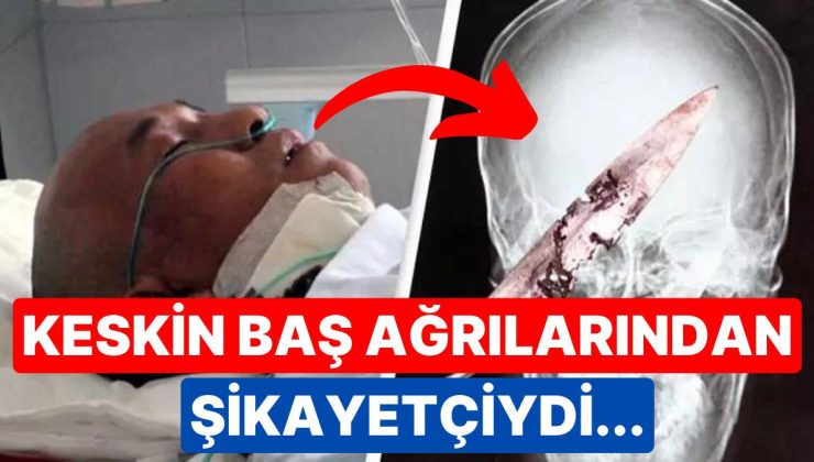 Dört Yıldır Baş Ağrısı Çeken Adamın Kafasında ‘Paslı Bıçak’ Kaldığı Öğrenildi