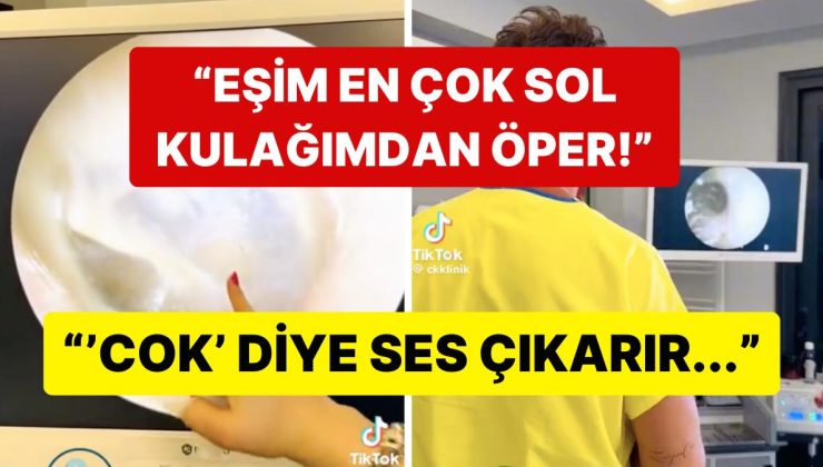 Yeni Fobi Yükleniyor: Eşini Öperken Kulağının Zarını Delen Adam Bu Kadarına da ‘Pes’ Dedirtti